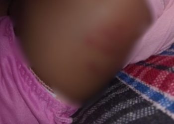 Veja: Bebê de 1 ano fica internada após apanhar do padrasto drogado em Itacoatiara