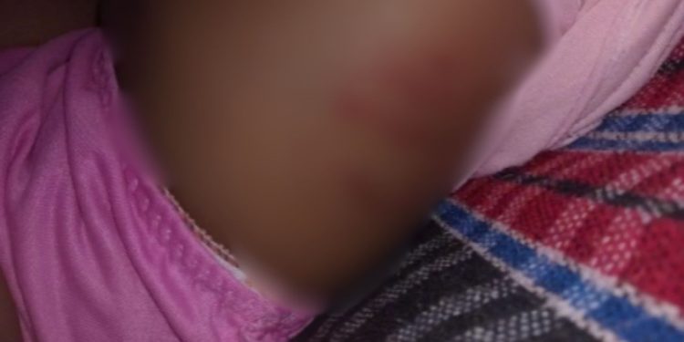 Veja: Bebê de 1 ano fica internada após apanhar do padrasto drogado em Itacoatiara