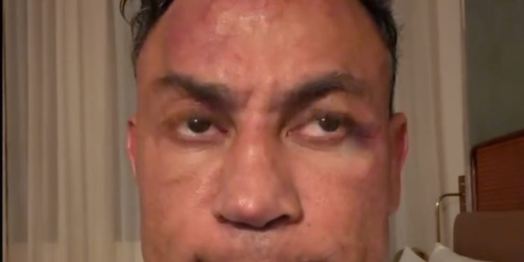 Veja o vídeo que Popó pede desculpas por briga pós-luta