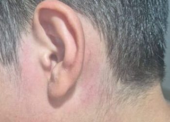 Vídeo mostra oficial da justiça agredindo criança; perfurou o tímpano