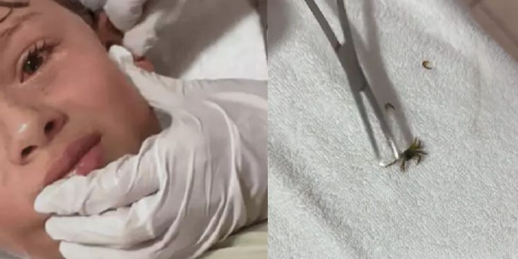 Vídeo: Filho de influenciadora tem caranguejo vivo retirado de ouvido após ida a praia