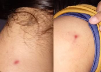 Em Manaus, estudante de 13 anos fica ferida após ser atacada pelas colegas