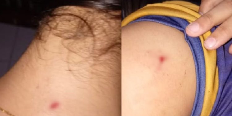 Em Manaus, estudante de 13 anos fica ferida após ser atacada pelas colegas