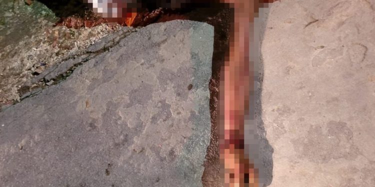 Sangrou até morrer após pegar facadas nas costas