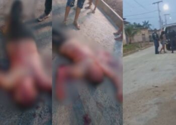 Veja como ficou o homem que foi esfaqueado pela esposa no interior do Amazonas