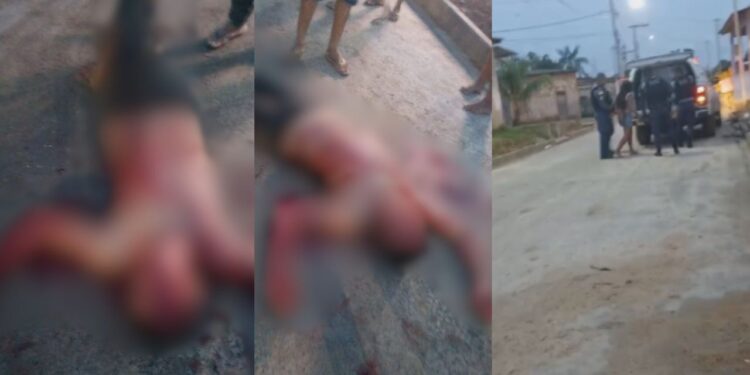 Veja como ficou o homem que foi esfaqueado pela esposa no interior do Amazonas