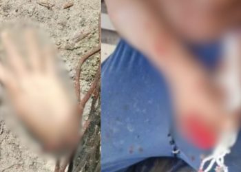 Polícia investiga caso de homem que teve a mão decepada em Maués