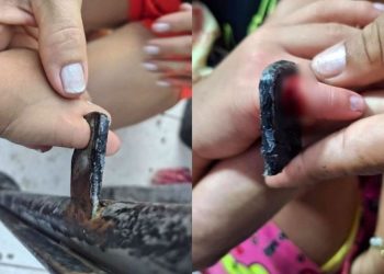 Vídeo: Bombeiros resgatam menina de 3 anos após prender dedo em portão em Manaus