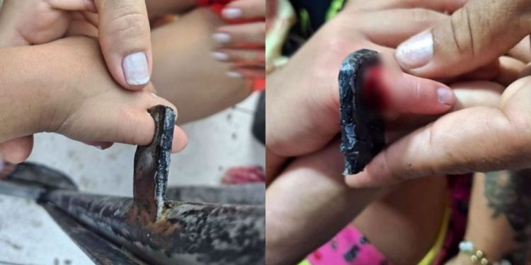 Vídeo: Bombeiros resgatam menina de 3 anos após prender dedo em portão em Manaus