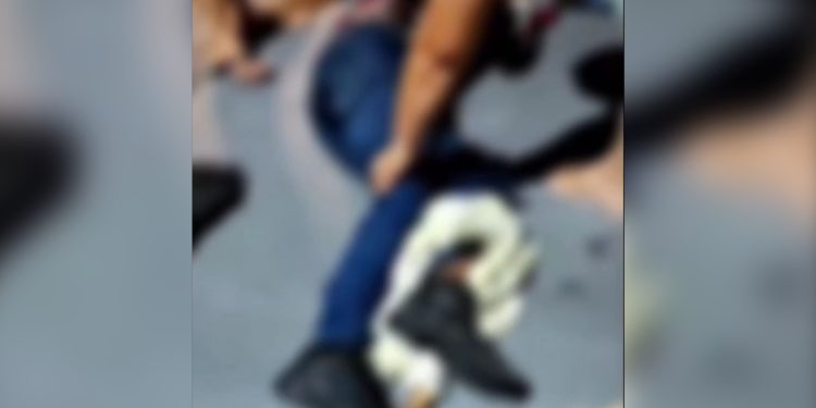 VÍDEO. Mototaxista tem fratura exposta após colisão no Novo Aleixo