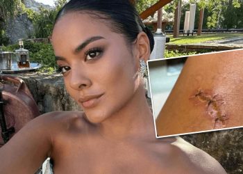 Bella Campos foi mordida por Jacaré; atriz da Globo conta os detalhes