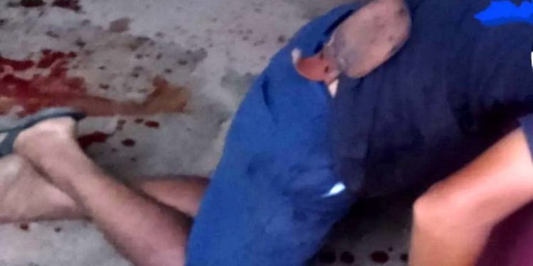 GOLPE FATAL – Morreu com facada na cabeça