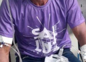 Raio atinge residência com nove pessoas dentro e deixa agricultor ferido em Itacoatiara