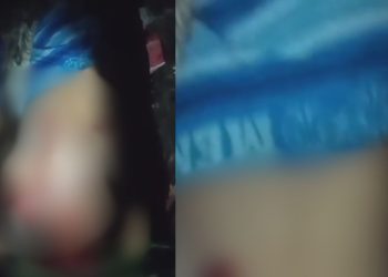 Vídeo bizarro mostra homem que teve a barriga aberta após ser morto em Manaus