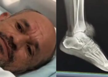 Em Presidente Figueiredo, homem acusa PM de baleá-lo no pé durante operação