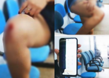 Violência acaba em mulher sendo arremessada de dentro de casa pelo ex