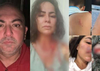 Em Manaus, advogado é acusado de bater na esposa e morder o filho; imagens fortes