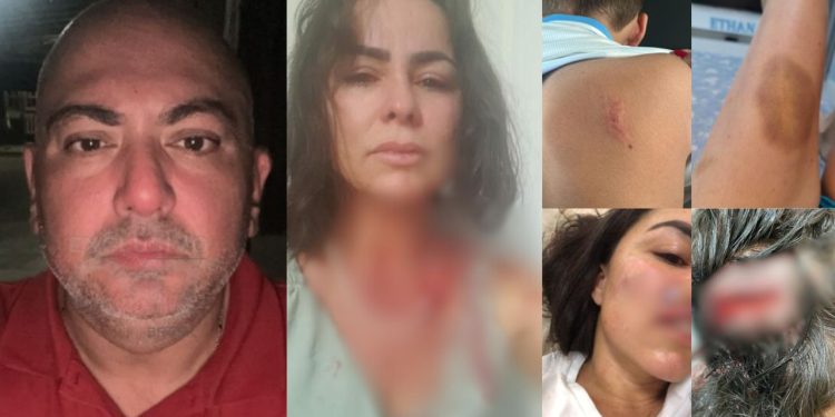 Em Manaus, advogado é acusado de bater na esposa e morder o filho; imagens fortes