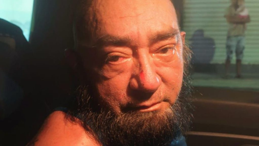 Após 20 anos de violência, mulher morre queimada com água fervente e homem é preso em Manaus