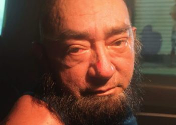 Após 20 anos de violência, mulher morre queimada com água fervente e homem é preso em Manaus