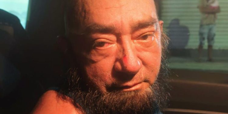 Após 20 anos de violência, mulher morre queimada com água fervente e homem é preso em Manaus