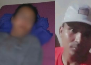 Veja: Valentão deixa a esposa com rosto inchado após socos em Coari