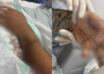 Em Manaus, passageiro ataca motorista de app com terçado e causa amputação de dedo