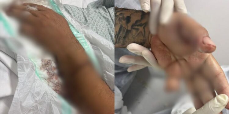 Em Manaus, passageiro ataca motorista de app com terçado e causa amputação de dedo