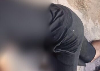 Teve a cabeça ext0ura@ de tiros enquanto vendia banana no Armando Mendes