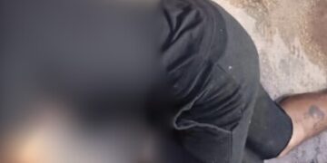 Teve a cabeça ext0ura@ de tiros enquanto vendia banana no Armando Mendes