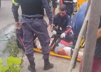 Vídeo forte mostra passageira de carro com perna em carne viva após capotamento