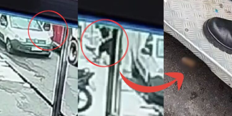 Veja o exato momento que homem tem o dedo amputado após ser atingido por ônibus em Manaus