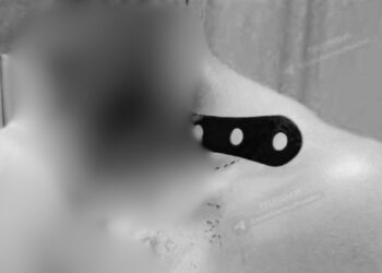 Mesmo depois de levar uma facada no pescoço, ladrão sobrevive