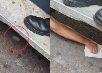 Ao ficar com a mão presa no ônibus, passageiro tem dedo amputado em Manaus