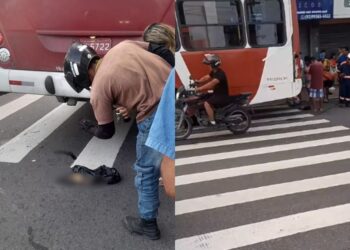 ‘RACHA’ DE AMARELINHOS – Passageiro tem braço arrancado em acidente