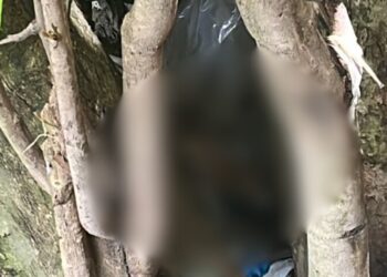 Encontradas pernas decepadas no Centro