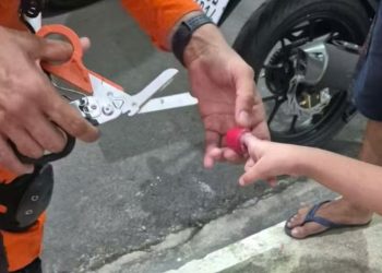 Brincando com massinha, menina de 4 anos prende dedo em recipiente em Petrópolis