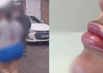 Presa bonita: mulher faz Botox com falso Pix e causa prejuízo de R$ 100 mil em Manaus