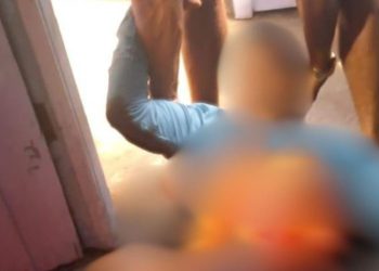 Veja: Após briga, homem leva facada na barriga e fica com as tripas para fora em Maués