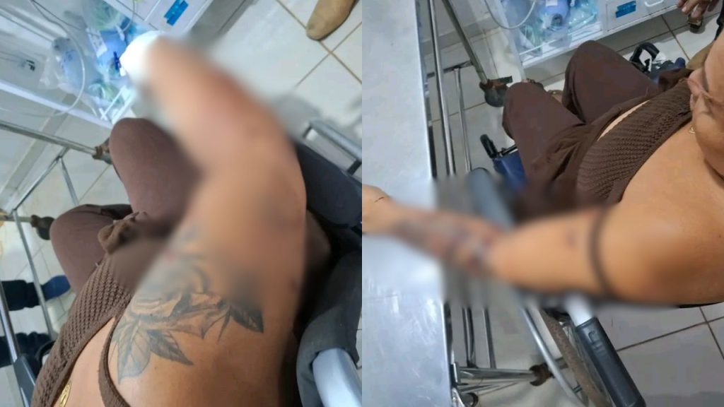 Com 27 facadas pelo corpo, mulher sobrevive após ataque do marido no Amazonas