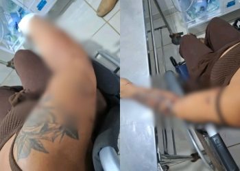 Com 27 facadas pelo corpo, mulher sobrevive após ataque do marido no Amazonas