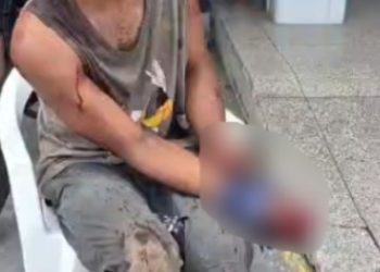 Após passar pelo 'Tribunal do crime', morador de rua tem dedos 'torados' em Manaus