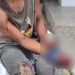 Após passar pelo 'Tribunal do crime', morador de rua tem dedos 'torados' em Manaus