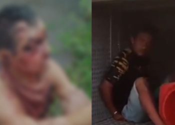 Por dívida de R$ 25, idoso é espancado, abandonado em mata em Coari