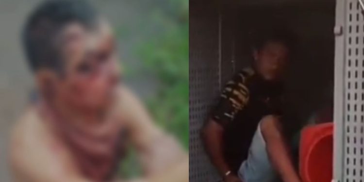Por dívida de R$ 25, idoso é espancado, abandonado em mata em Coari