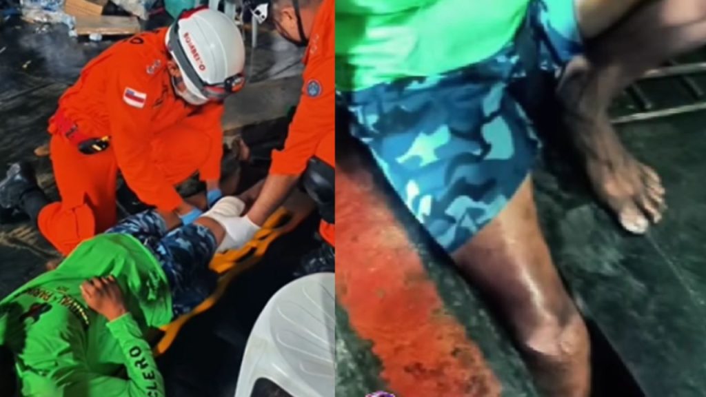Ao cair de embarcação, homem fica com a perna presa no porto e é resgatado em Parintins