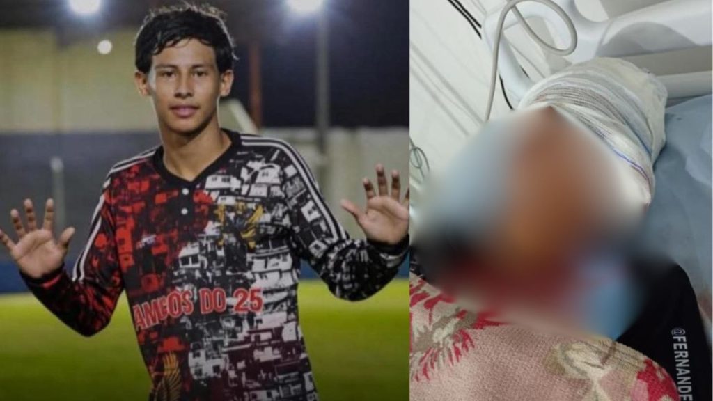 Em Maués, adolescente é baleado na cabeça e transferido para Manaus em estado grave