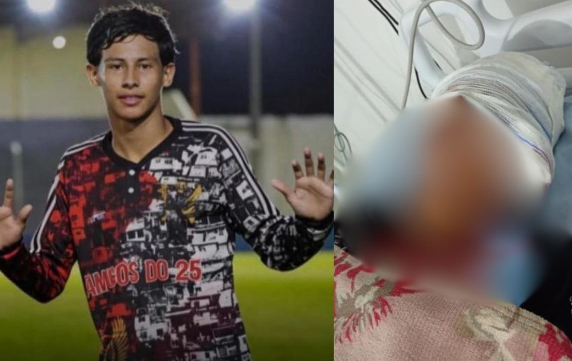 Em Maués, adolescente é baleado na cabeça e transferido para Manaus em estado grave
