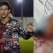 Em Maués, adolescente é baleado na cabeça e transferido para Manaus em estado grave
