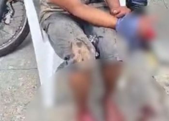 Ladrão tem os dedos amputados por justiceiros